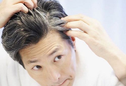 6 Home Remedies To Reverse Premature Greying of Hair