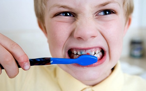 brushing brushed dentist mulut kesihatan sebabkan penuh perut bakteria ulser delapan merusak menggosok wanista