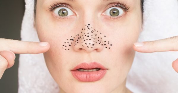 Diy Face Mask For Blackheads Removal